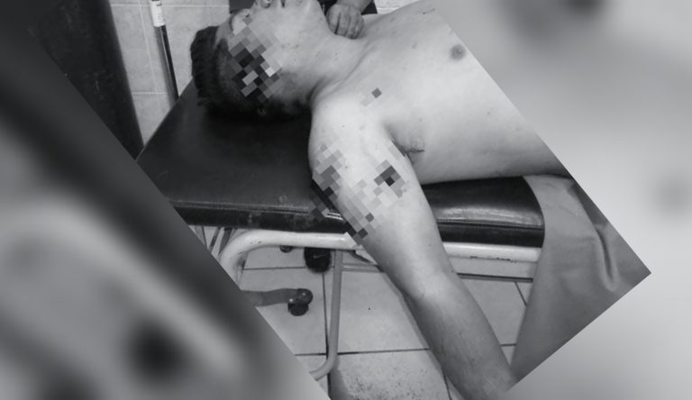 Hombre casi pierde la vida tras ataque grupal en Palpa - Perú
