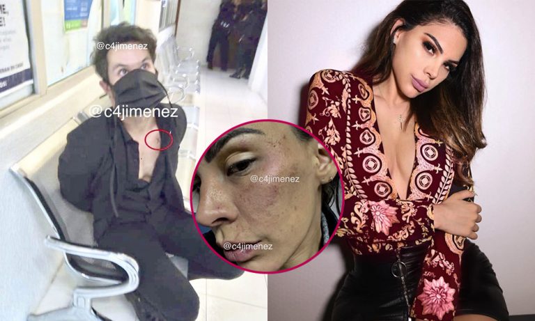 Revelan imágenes de la salvaje agresión que sufrió Stephanie Valenzuela por su pareja Eleazar Gómez - Entretenimiento