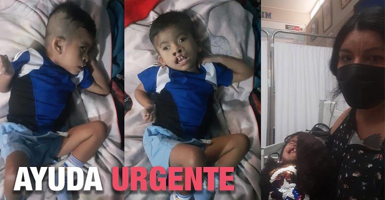 Jassiel, Dona y ayuda al niño de 3 años con malformaciones y otros males - Perú