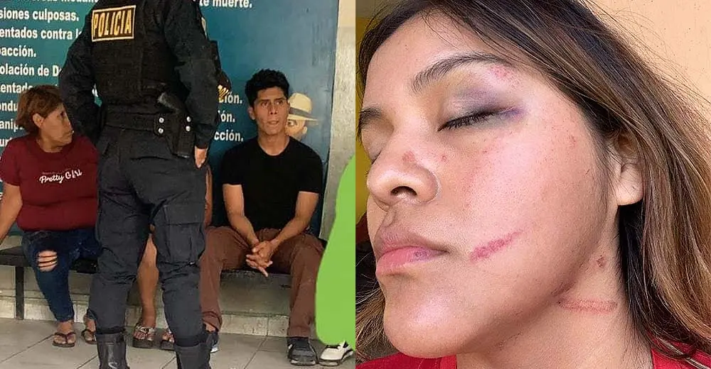 Ica: Repartidora Delivery cuenta cómo fue brutalmente agredida durante una entrega en Navidad