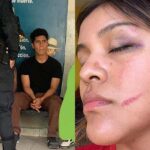Ica: Repartidora Delivery cuenta cómo fue brutalmente agredida durante una entrega en Navidad