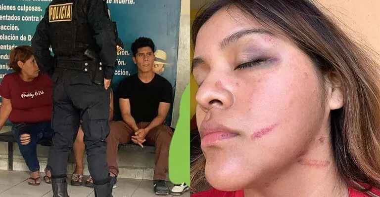 Ica: Repartidora Delivery cuenta cómo fue brutalmente agredida durante una entrega en Navidad - Ica