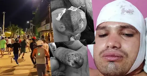 Casi queman vivo a boxeador iqueño en Madre de Dios y requiere apoyo para volver con su familia