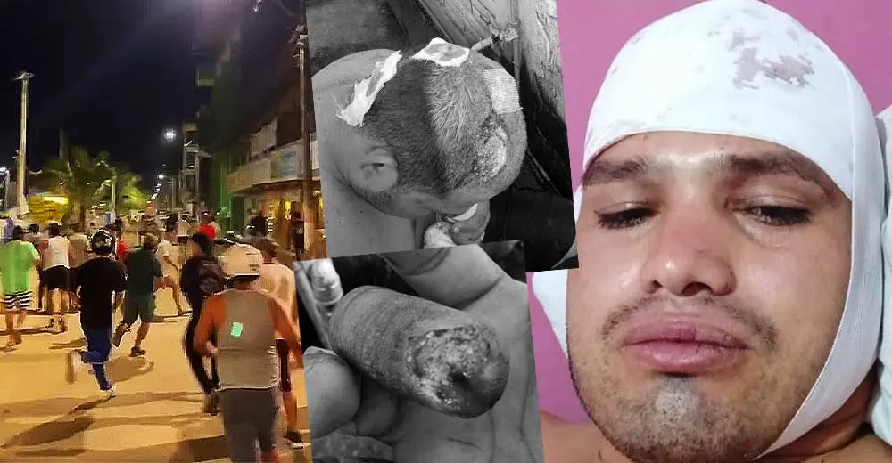 Casi queman vivo a boxeador iqueño en Madre de Dios y requiere apoyo para volver con su familia