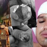 Casi queman vivo a boxeador iqueño en Madre de Dios y requiere apoyo para volver con su familia