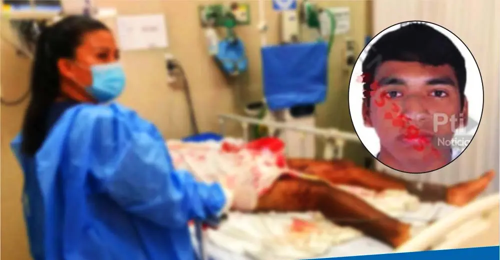 Pisco: Hombre que se detonó una dinamita en las manos falleció tras complicaciones