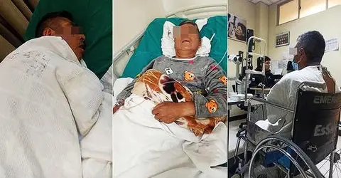 Ica: Hombre queda ciego tras accidente de un fundo de empresa agroexportadora