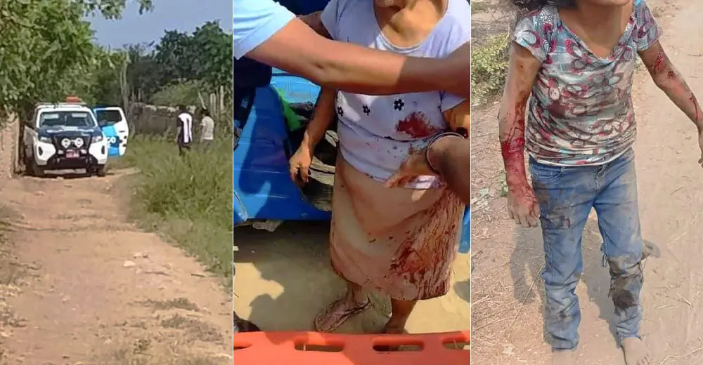 Chincha: Perros de raza rottweiler atacan y casi matan a dos mujeres