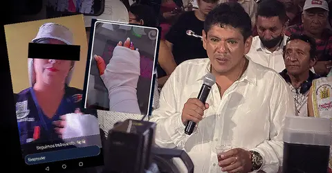 Ica: Regidor provincial José Luis Escate es acusado de agredir violentamente a su pareja