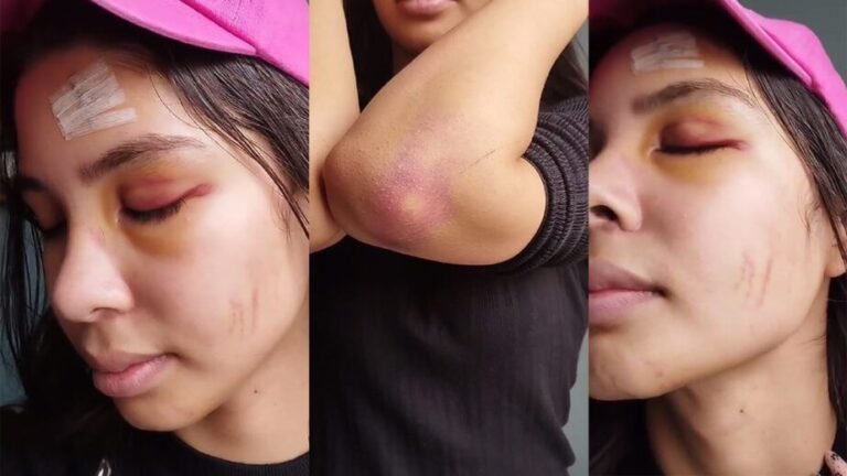 Arequipa: el infierno de miss Sachaca que casi la convierte en víctima de feminicidio - Perú