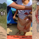 Chincha: Perros de raza rottweiler atacan y casi matan a dos mujeres