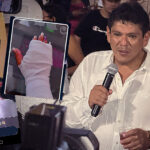 Ica: Regidor provincial José Luis Escate es acusado de agredir violentamente a su pareja