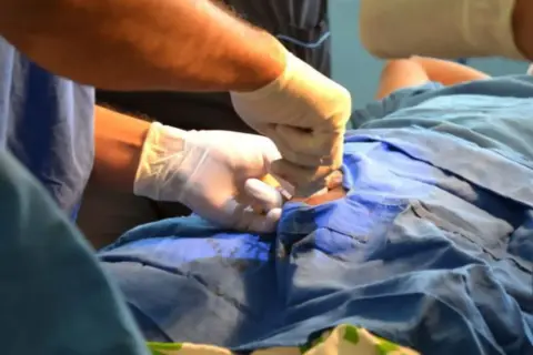 Estos son los hospitales de Ica para hombres que quieran hacerse la vasectomía gratis por campaña del Minsa