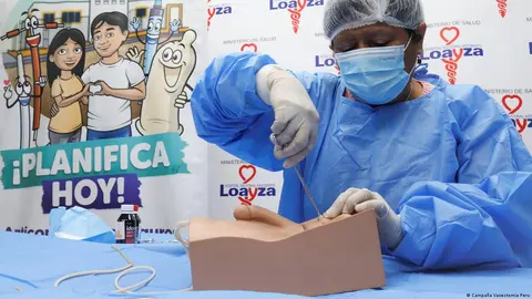 Minsa inicia jornada nacional de vasectomías gratuitas en 73 hospitales: conoce dónde y cómo acceder