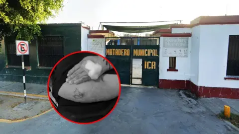 Ica: Alerta por posible contagio de carbunco a una trabajadora del Camal Municipal