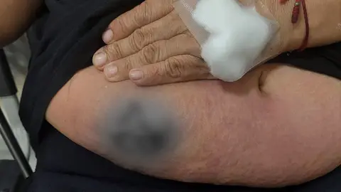 Ica: Análisis del INS dio negativo para 'Carbunco' en paciente EsSalud del Camal Municipal