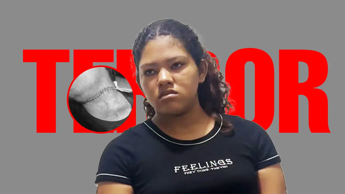 Juez libera a mujer que atacó con cúter y dejó corte de 20 cm en el cuello a comerciante en Chincha