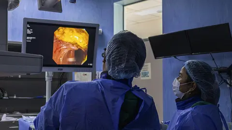 Médicos de Ica salvan a paciente tras extraer gigantesco cálculo hepático