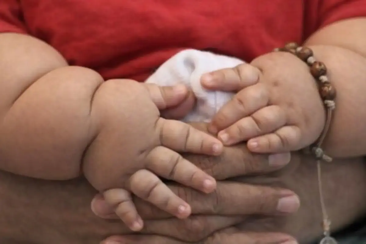 Minsa: 149,622 niños menores de 5 años con exceso de peso en 2025