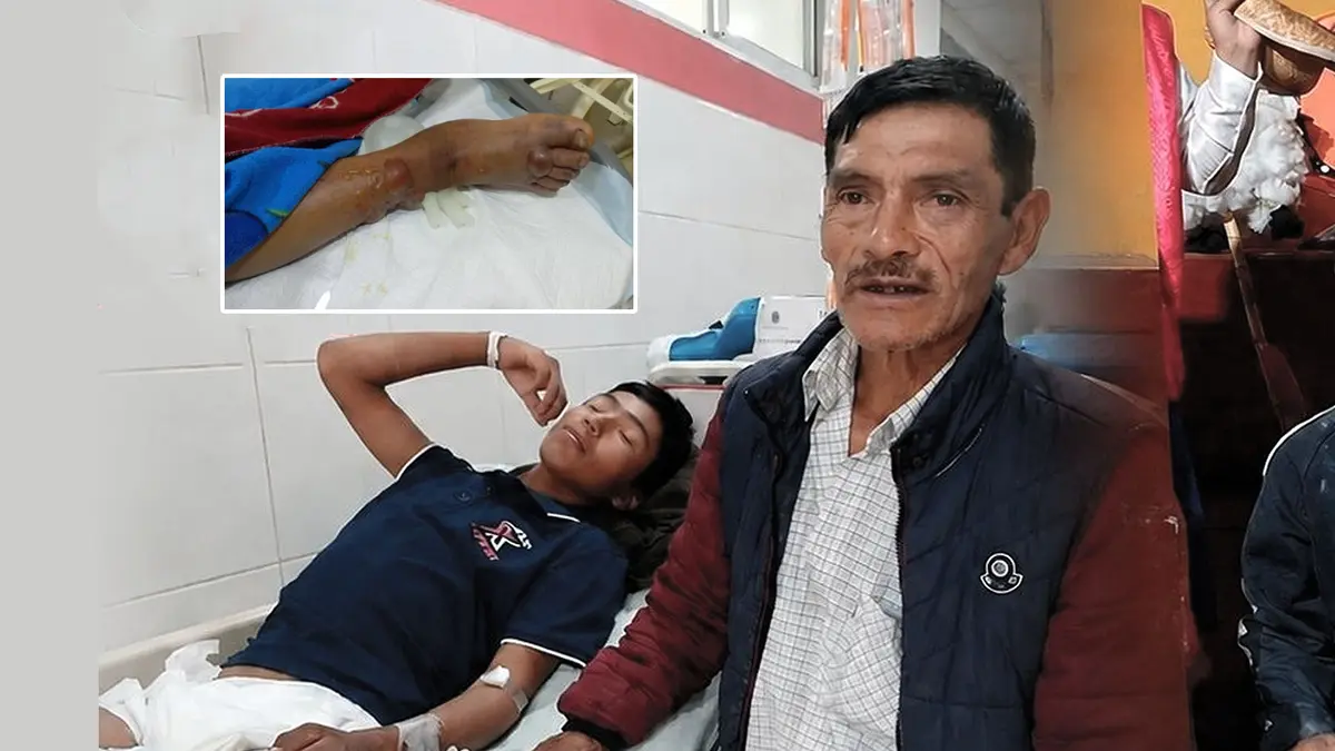 Estudiante de 16 años lucha por su vida tras ser mordido por una víbora en Huancavelica
